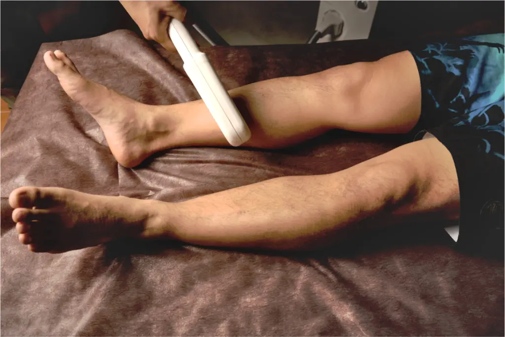 メンズvio脱毛でちんこデカくなるらしいよ 体験してきた アンロミー